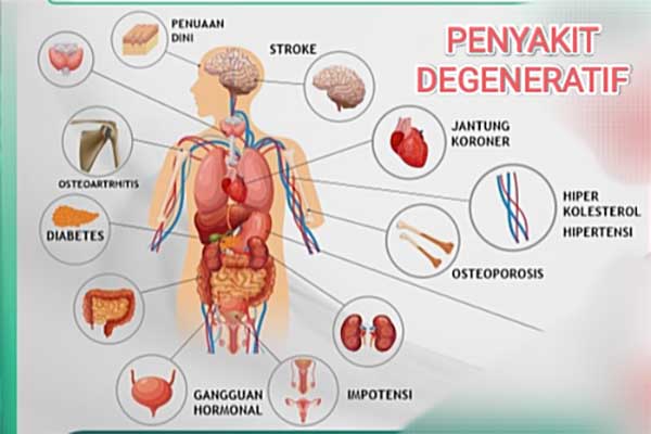 Tangkal Penyakit Degeneratif dengan Gaya Hidup Sehat Sejak Muda