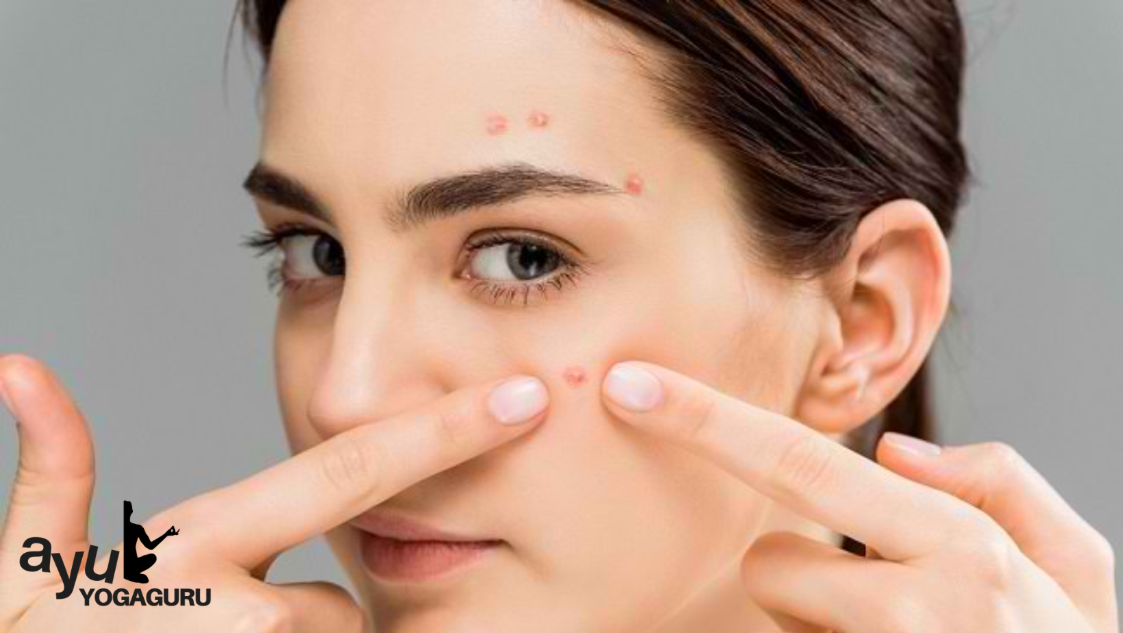 Kebiasaan Sehat untuk Kulit Bebas Jerawat dan Lebih Bersinar