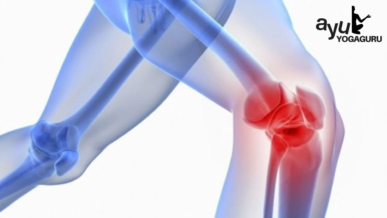 Olahraga Terbaik untuk Mencegah Keropos Tulang di Masa Depan: Pilihan yang Efektif untuk Kesehatan Tulang Anda