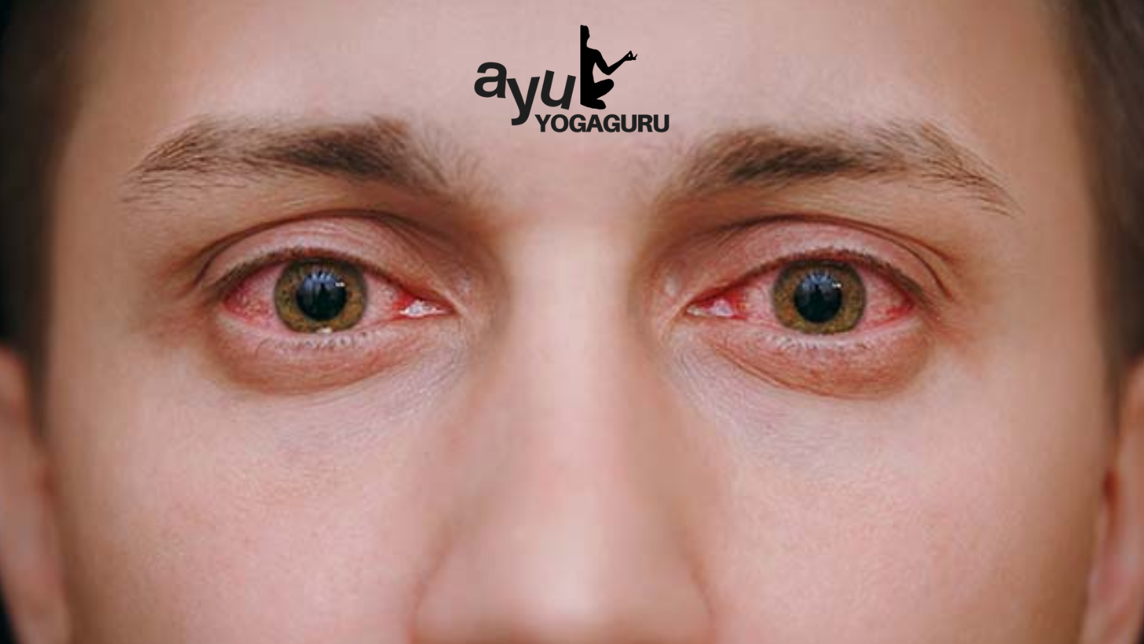 Cara Efektif Mengatasi Mata Kering Akibat Terlalu Sering Menatap Layar